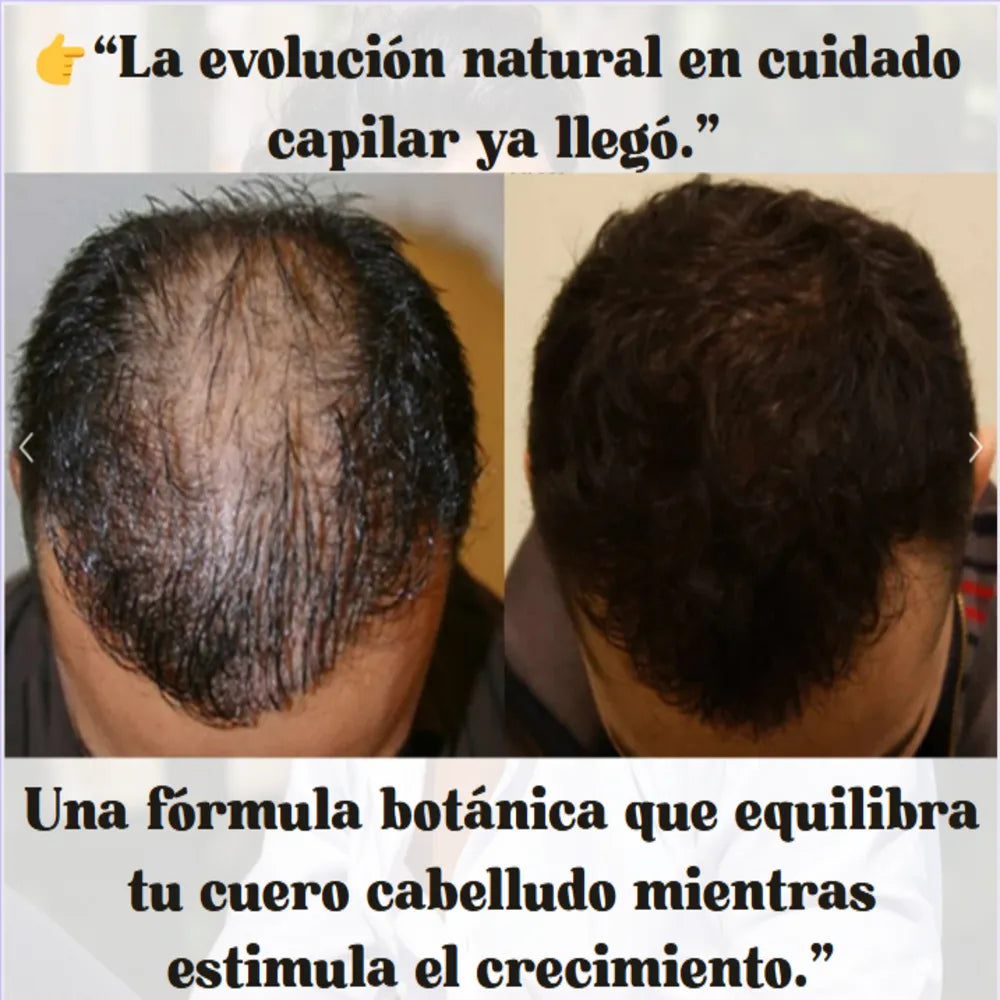 “Serúm de crecimiento Real. Fórmula Natural.”