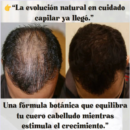 “Serúm de crecimiento Real. Fórmula Natural.”